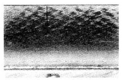 1648880717112497.png CL-100(1).png